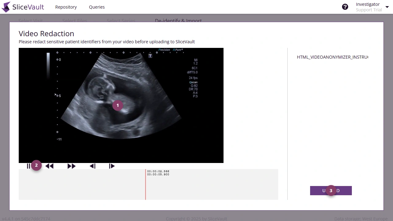 Screenshot: Video Masking with markers