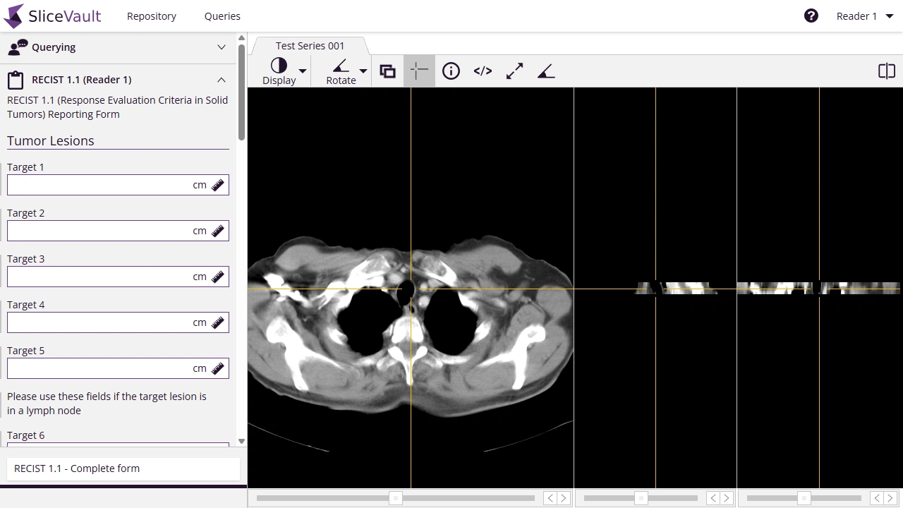 Opening an assessment form