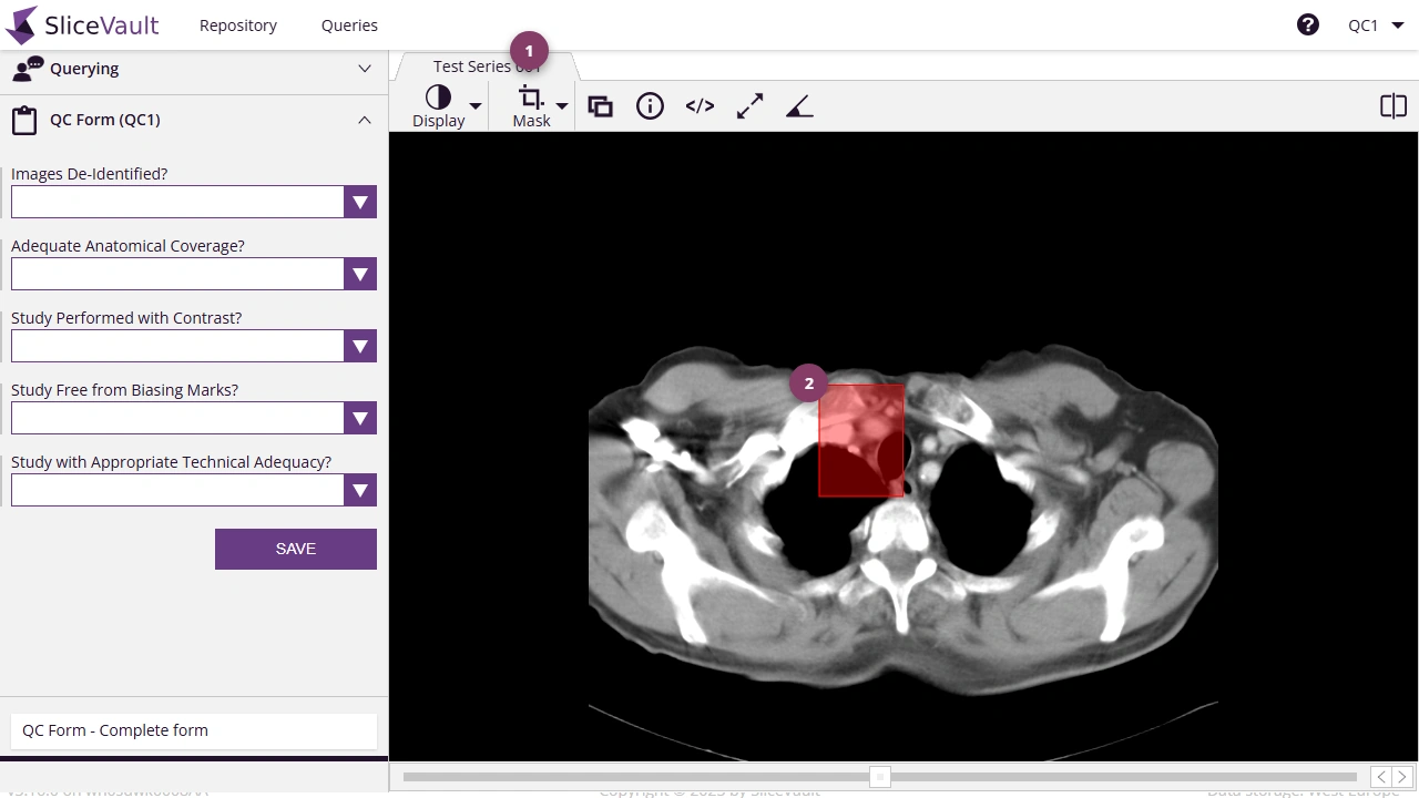 Screenshot - Masking data