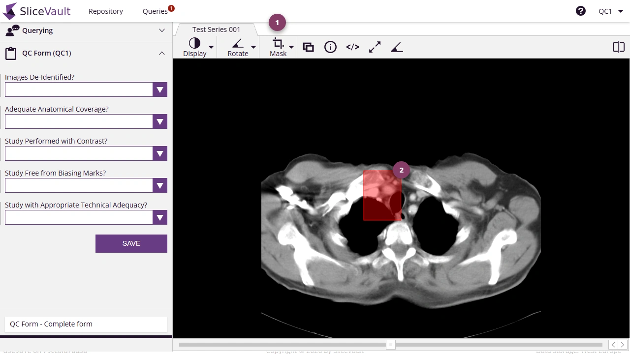 Screenshot - Masking data