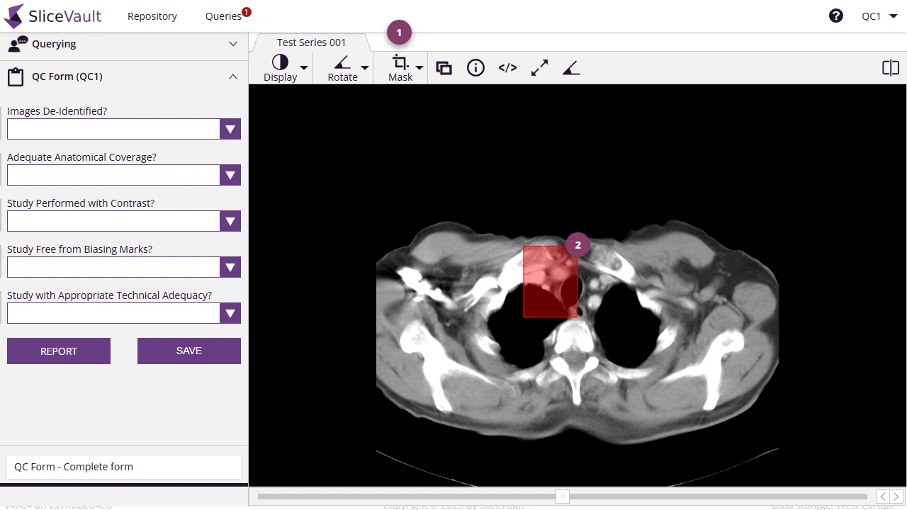 Screenshot - Masking data