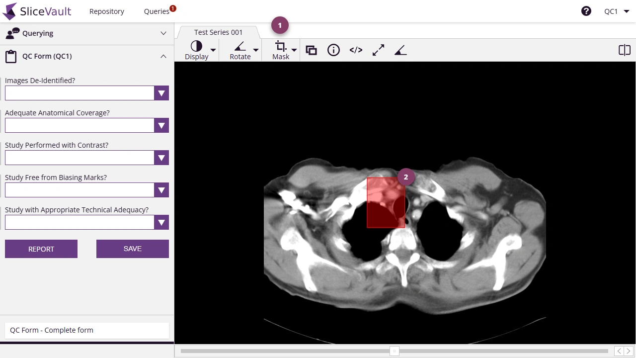 Screenshot - Masking data