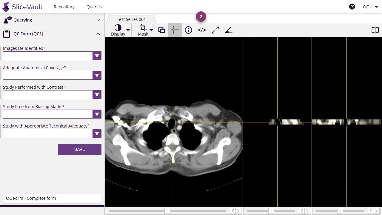 Screenshot: Edit DICOM Tag from the DICOM viewer