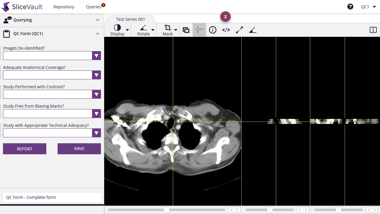 Screenshot: Edit DICOM Tag from the DICOM viewer