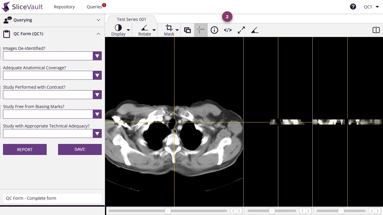 Screenshot: Edit DICOM Tag from the DICOM viewer