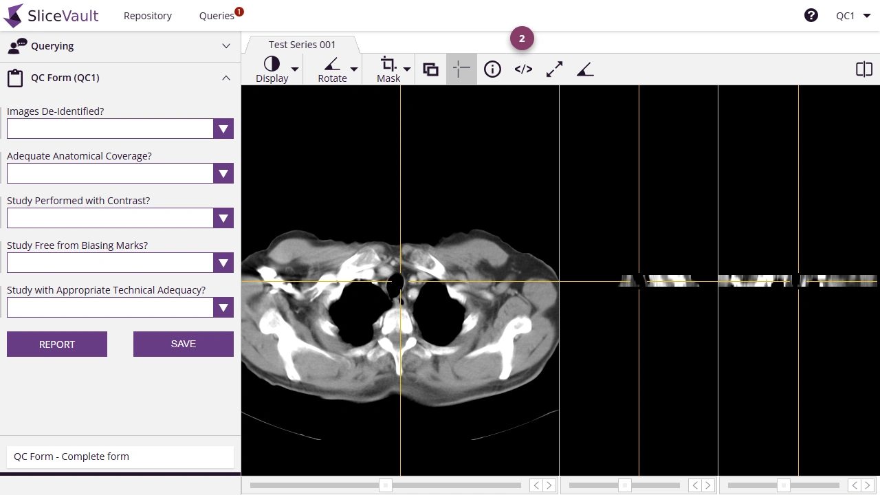 Screenshot: Edit DICOM Tag from the DICOM viewer