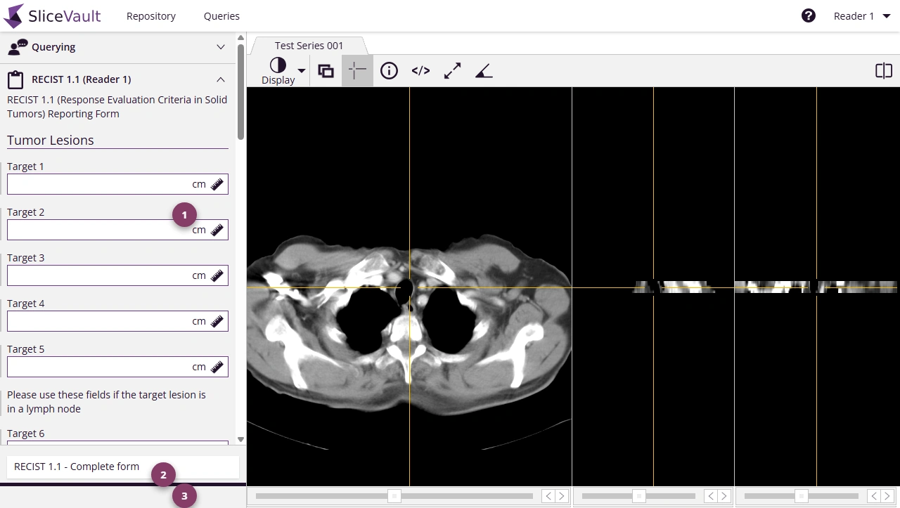 Screenshot - Open Assessment Form