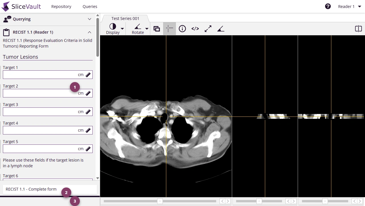 Screenshot - Open Assessment Form
