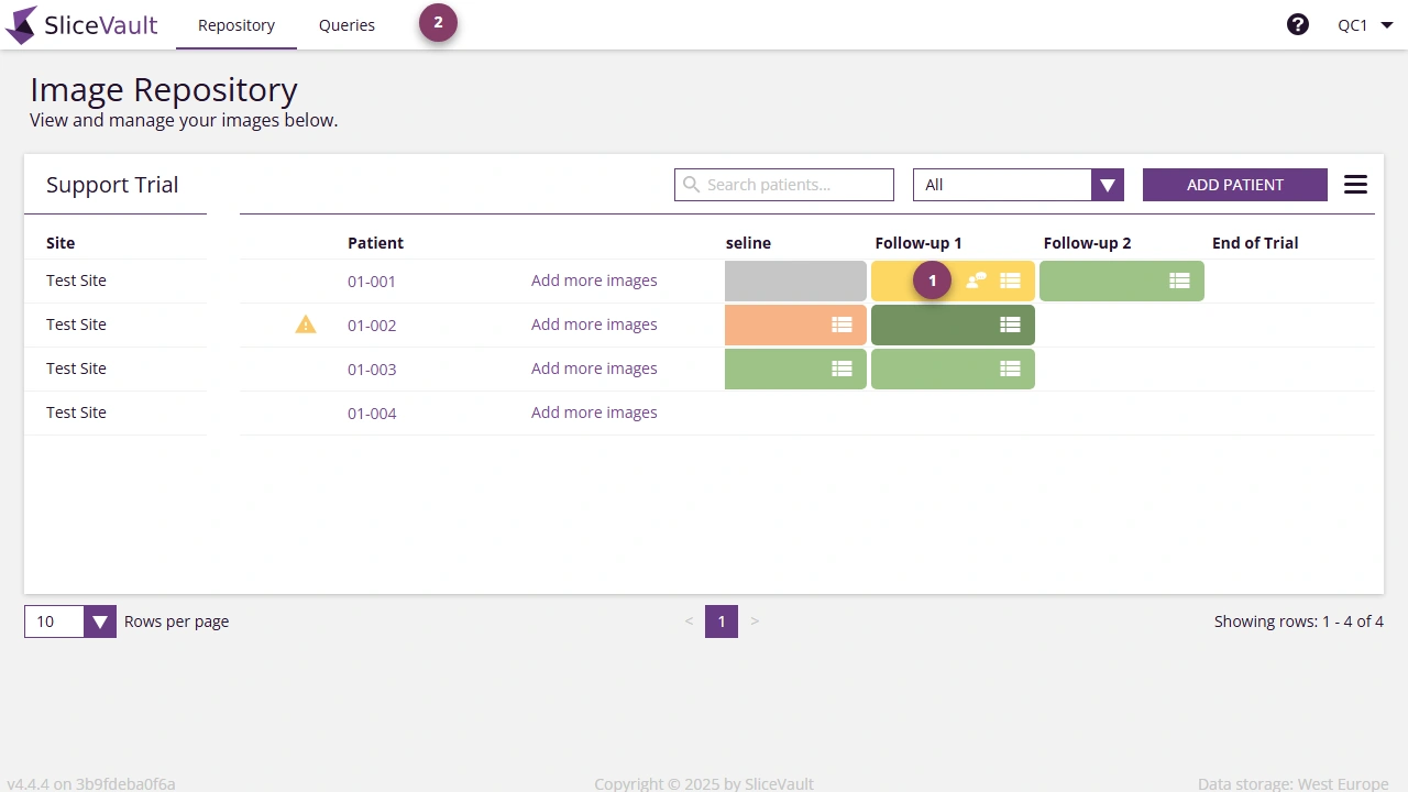 Screenshot - Query Icons on Repository Page