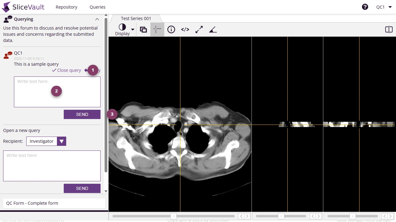 Screenshot - Post Reply to Query