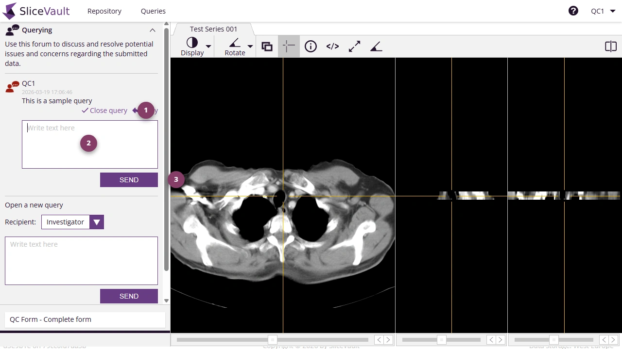 Screenshot - Post Reply to Query