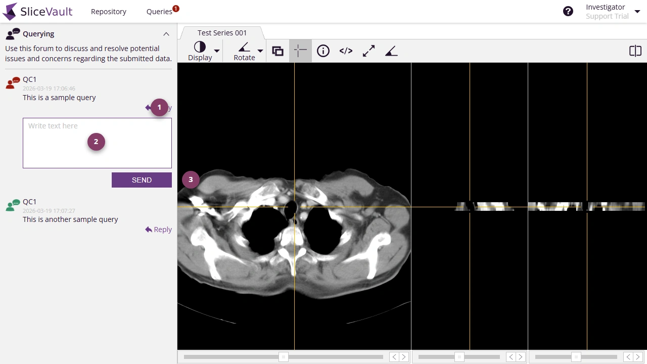 Screenshot - Post Reply to Query
