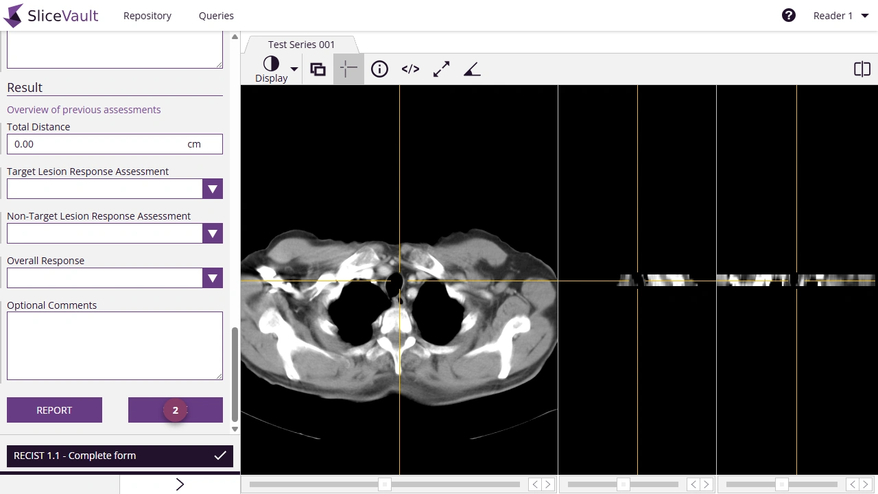 Screenshot - Edit Assessment Form