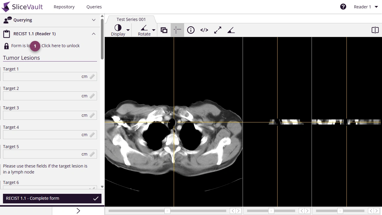 Screenshot - Unlock Assessment Form