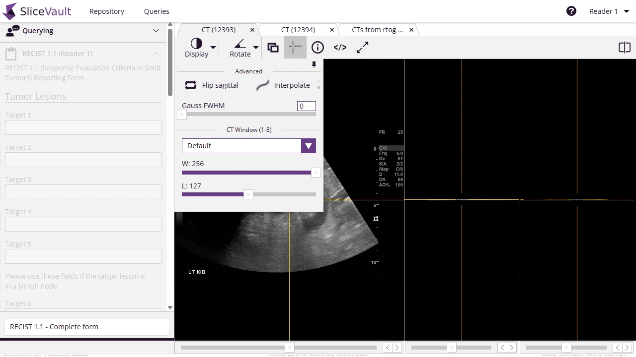 Screenshot - Viewer Display Menu