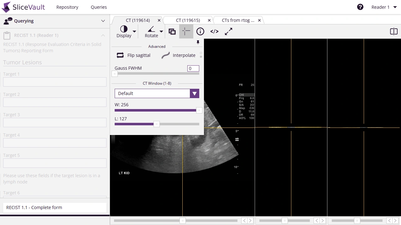 Screenshot - Viewer Display Menu