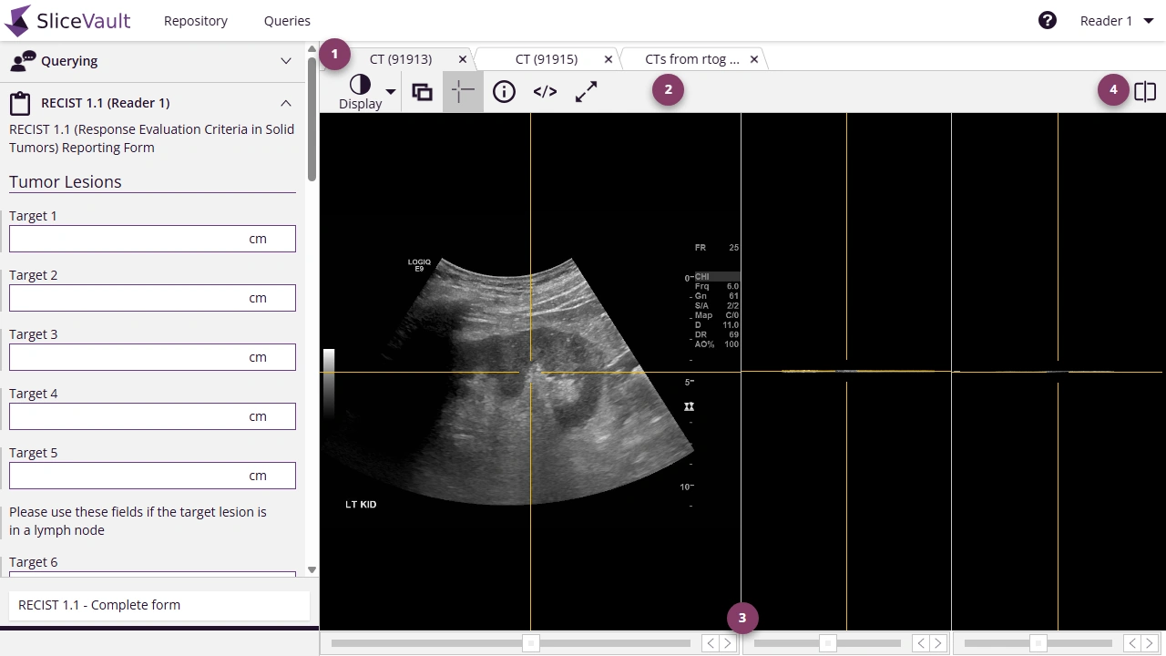 Screenshot - SliceVault DICOM Viewer