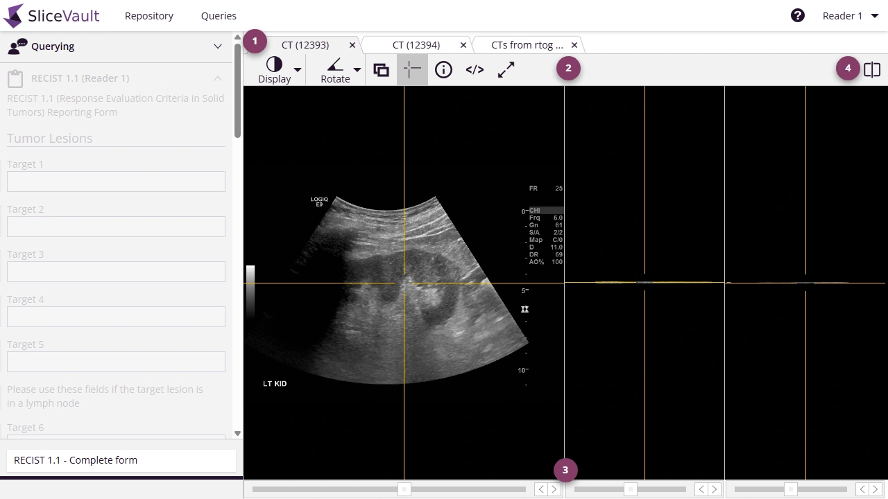 Screenshot - SliceVault DICOM Viewer